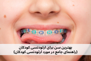 بهترین سن برای ارتودنسی