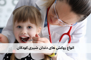 انواع روکش های دندان شیری کودکان