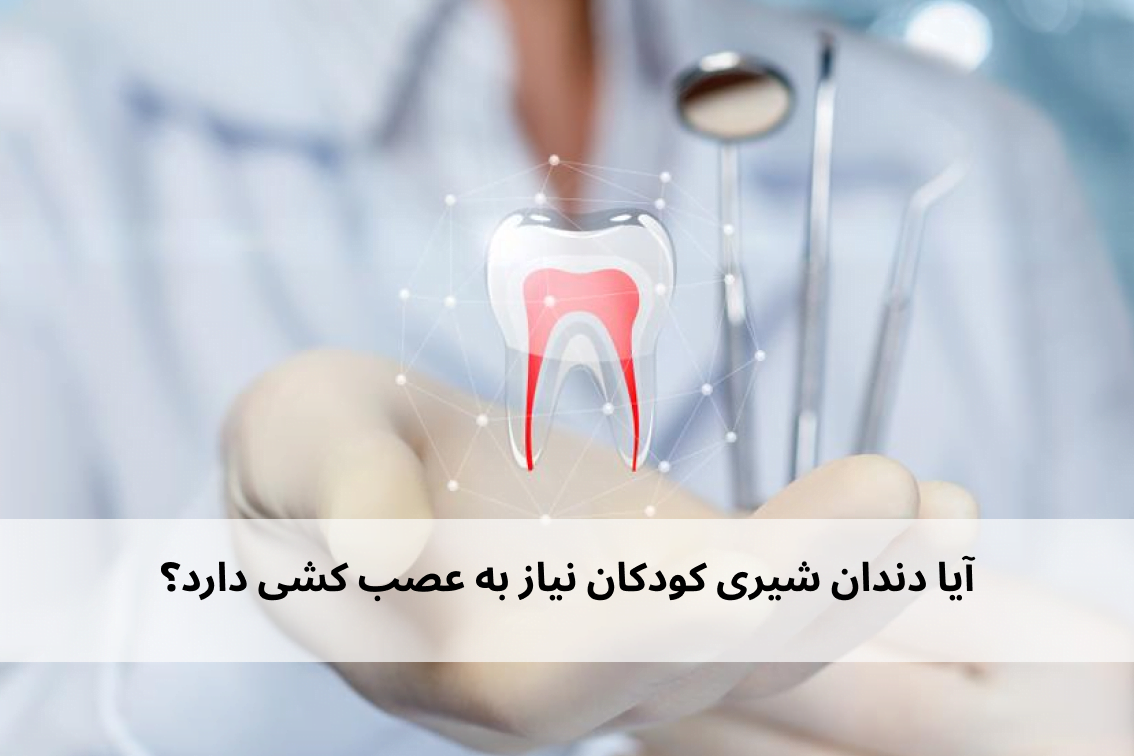 آیا دندان شیری کودکان نیاز به عصب کشی داد