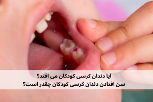 تعداد دندان های شیری