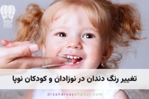 تغییر رنگ دندان در نوزادان
