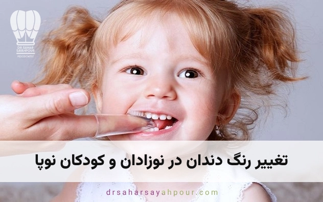 تغییر رنگ دندان در نوزادان