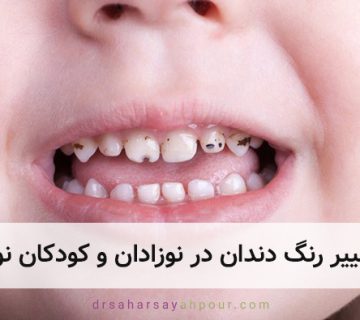دلایل خراب شدن دندان شیری کودکان